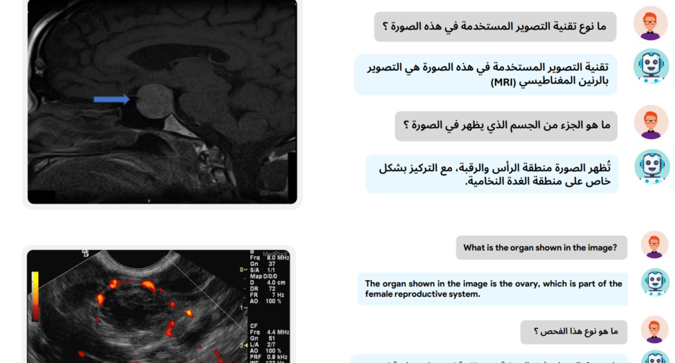 Researchers develop first AI system for analyzing medical imagery in both English and Arabic