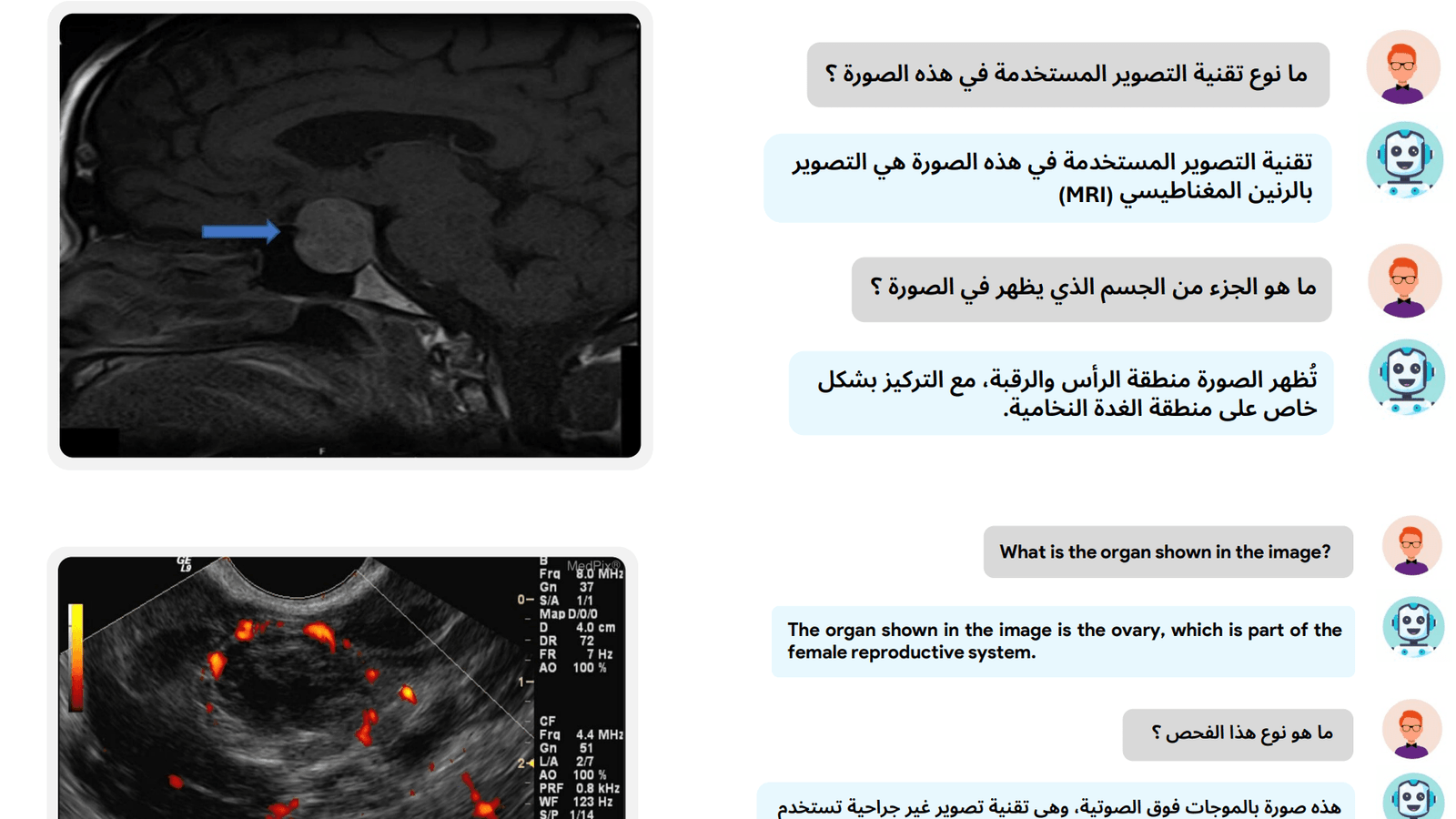 Researchers develop first AI system for analyzing medical imagery in both English and Arabic